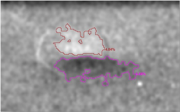 1592814687328216.png dent.png